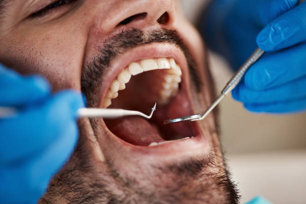 Best Emergency Broken Tooth Repair in Vine Grove, KY